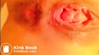 Anal self fisting prolapsed with little shit, ScatKings.com Scat Porn 12 ScatKings.com Scat Porn