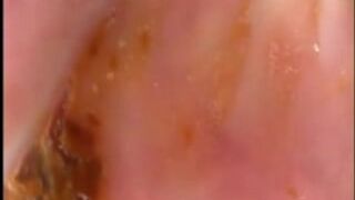Camera in Arse with poo Asian. Buttcam, ScatKings.com Scat Porn 7 ScatKings.com Scat Porn