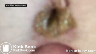 Liquid Shit Anal Fuck, ScatKings.com Scat Porn 27 ScatKings.com Scat Porn