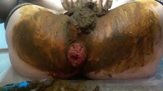 Prolapsed scat.., ScatKings.com Scat Porn 23 ScatKings.com Scat Porn