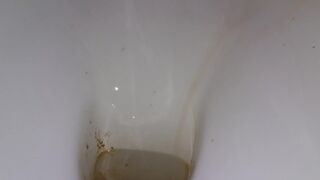 diarrhea - video 71, ScatKings.com Scat Porn 16 ScatKings.com Scat Porn