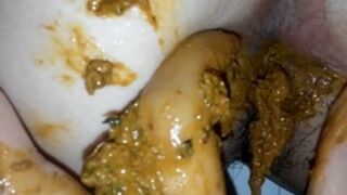 korean scat4, ScatKings.com Scat Porn 15 ScatKings.com Scat Porn